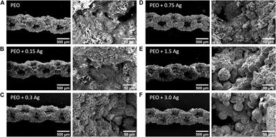 The response of human macrophages to 3D printed titanium antibacterial implants does not affect the osteogenic differentiation of hMSCs